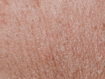 Close-up of human skin texture